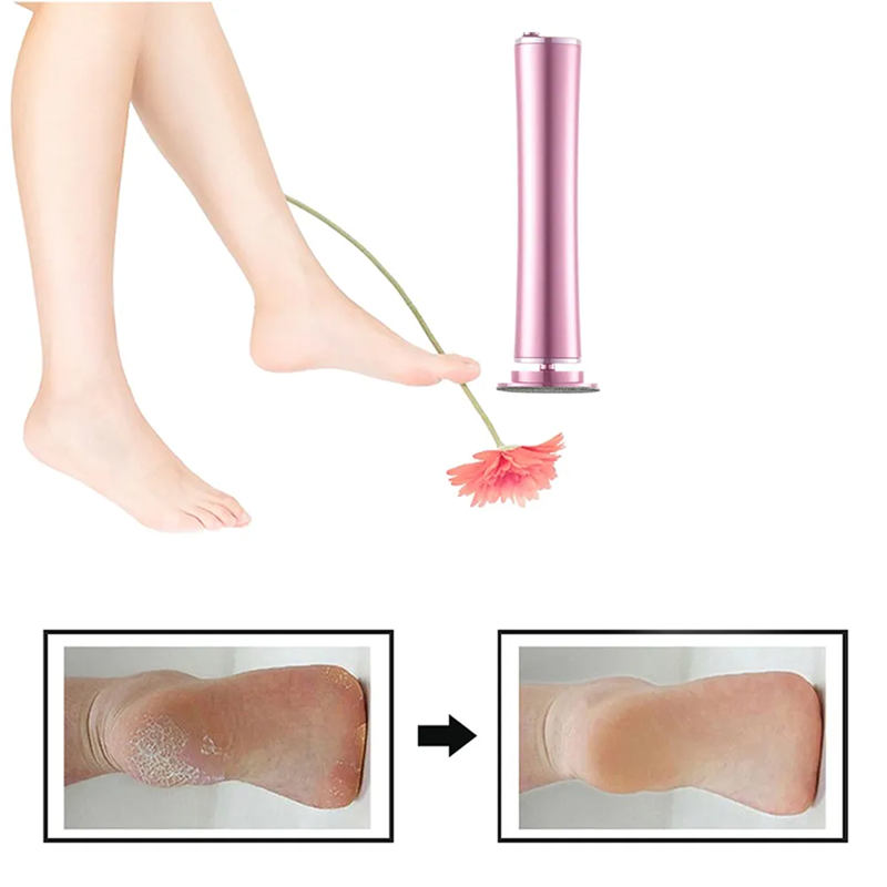 Elektrischer Hornhautentferner Pro ✨